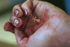 Acts 14:22b, “… we must through much tribulation enter into the kingdom of God.”